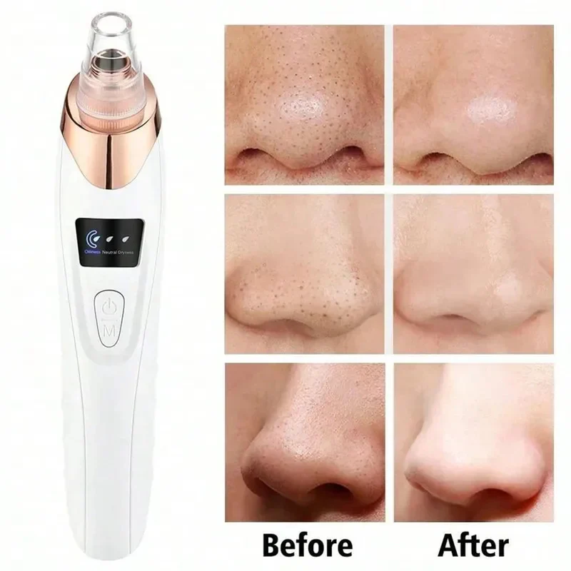 PoreCleaner Pro™ Plus (6 Heads + Steel Toolkit)🎁