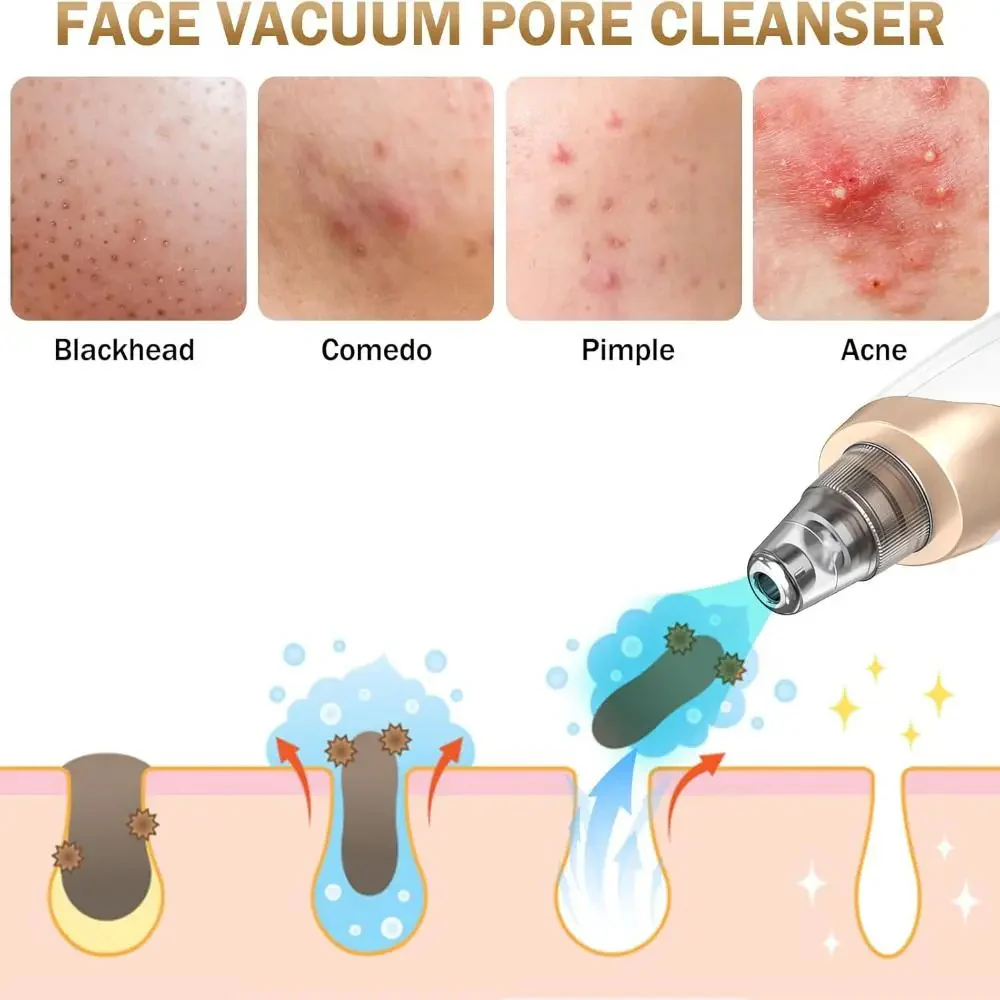 PoreCleaner Pro™ Plus (6 Heads + Steel Toolkit)🎁 - Image 4